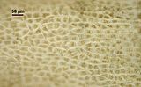 Arthrocladia villosa6